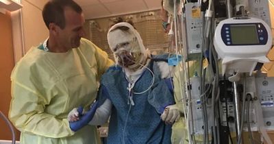 Woman Burned In Gas Station Explosion Stuns The Internet With Transformation 6 Years Later