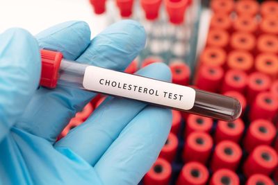 Shop-bought health tests not always fit for purpose, researchers warn