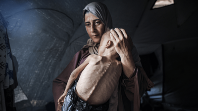 ‘It’s A Mass-Starvation, And It’s Man-Made’: Gaza’s Hunger Crisis Death Toll Hits 111