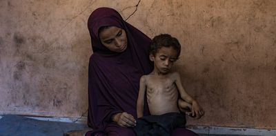 Gaza is starving – how Israel’s allies can go beyond words and take meaningful action