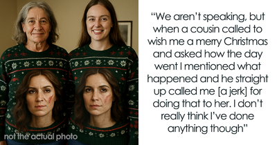 GF With Facial Scar Is The Butt Of BF’s Family’s Joke, Storms Out Of Christmas Gathering