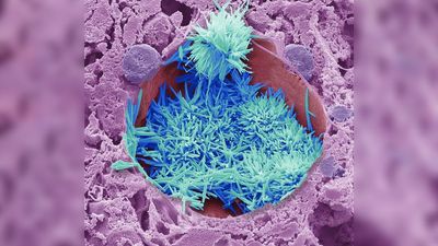 This image shows something you wouldn't expect to see – and it's among the winners of this year's Wellcome Photography Prize
