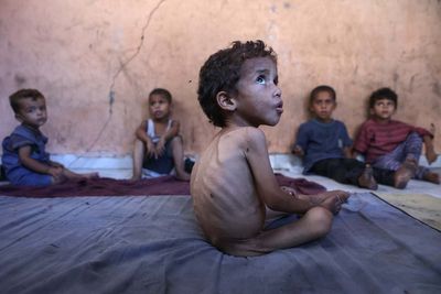 UN says one in five children in Gaza now malnourished
