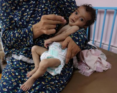 Israel trying to deflect blame for widespread starvation in Gaza