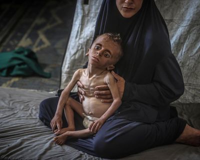 Severe malnutrition in under-5s has tripled at Gaza City clinic, charity reports