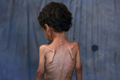 UK, France, Germany Say Gaza 'Humanitarian Catastrophe Must End Now'