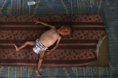 UN Chief Blasts 'Lack Of Compassion' For Palestinians In Gaza