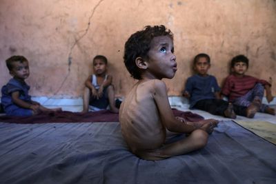 'Famine', 'Starvation': The Challenges In Defining Gaza's Plight