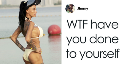 “Deflated Balloon”: Katie Price Shares Why She Got More Work Done On Her Bum, But Admits Pain