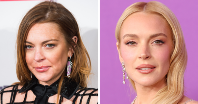 “10 Years Younger”: Experts Weigh In On Lindsay Lohan’s Fresh-Faced Glow Amid Plastic Surgery Drama