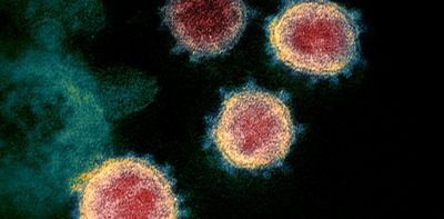 Long-COVID, viruses and ‘zombie’ cells: new research looks for links to chronic fatigue and brain fog