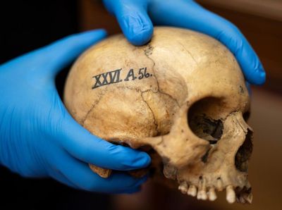 Edinburgh University’s ‘skull room’ highlights its complicated history with racist science