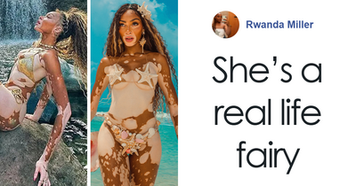 “Michael Jackson Probably Would’ve Been Fascinated By Her”: 31-Year-Old Winnie Harlow Goes Viral
