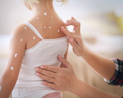 Sight of someone potentially infectious causes immune response, research suggests