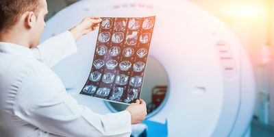 Revvity Slashes Outlook As China Policy Deals Diagnostics Blow