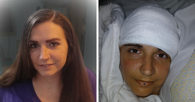 Paralyzed Woman Stuns Internet By Showing What Elon Musk’s Neuralink Brain Chip Can Do