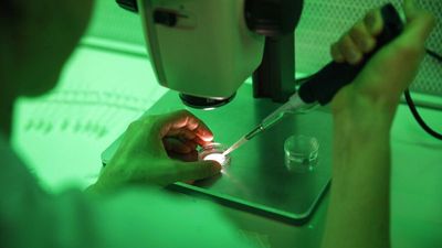 Experimental treatment restores sight to man with genetic eye disorder in Italy