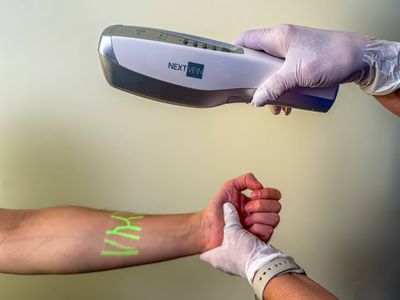 Revealing What's Beneath the Surface: Vein Visualization Is Improving Patient Care