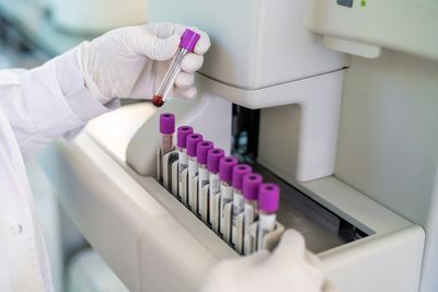 Unique blood test could catch cancer early