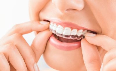 Is Align Tech Dental Aligner Demand Falling Compared To Traditional Braces?