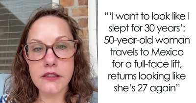 51YO Documents Progress Of Her Facelift, Leaves 125 Million People Baffled Over Results