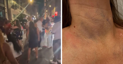 Gruesome Photos Of Cincinnati Brawl Victim’s Swollen Face Spark Outrage As Racial Tensions Erupt