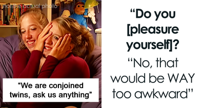 Conjoined Twins Answer 24 People’s Most Interesting And Burning Questions