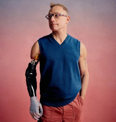 He worked with artificial limbs for decades. Then a lorry ripped off his right arm. What happened when the expert became the patient?