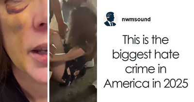 “No One Deserves This!”: Woman Beaten In Cincinnati Attack Speaks About Her Recovery