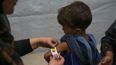 How malnutrition in Gaza is devastating children's health