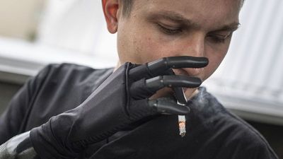 Ukraine war leads to heightened demand for bionic prosthetic limbs