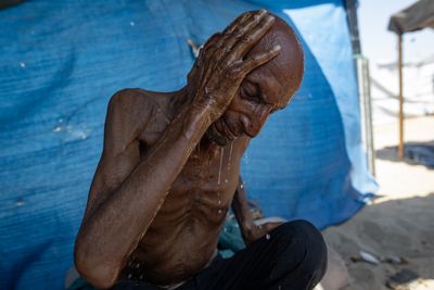 What ‘starvation’ really means, for the human body and for Gaza