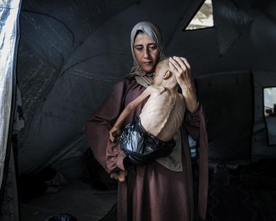 We published a photo of a malnourished child in Gaza. It made an impact globally – and created controversy