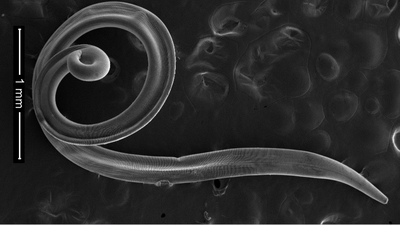 Diagnostic dilemma: A woman had something in her eye — and it turned out to be parasitic worms