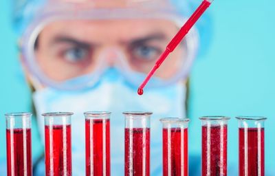 Exact Sciences Dip A Chance To Buy As Freenome Deal Fortifies Future: Analyst
