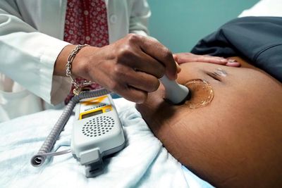 I’m a perinatal psychiatrist. The US is promoting misinformation on SSRIs and pregnancy