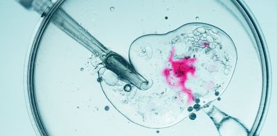 Weight loss support before IVF could boost pregnancy chances – and reduce the need for treatment
