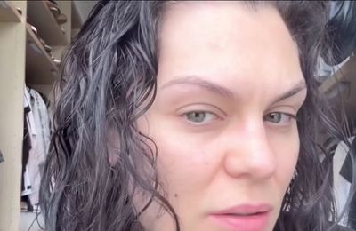 Jessie J's hair 'is falling out like crazy'