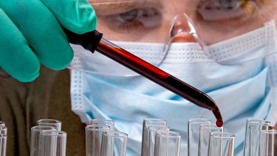 Zevra Therapeutics Crashes, Reversing 89% Run. Why It Could Be An 'Overreaction.'