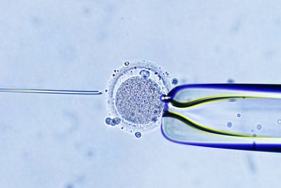 Silicon Valley executives are spending up to $50,000 to screen embryos