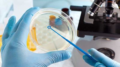 Lyme Disease Is Spiking. This Biotech Nears A Treatment And A Buy Point.