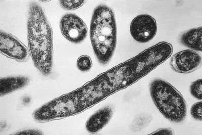 4th person dies after a Legionnaires’ disease outbreak sickens dozens in New York City