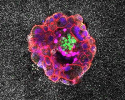 Scientists capture first footage of human embryo implanting in a uterus