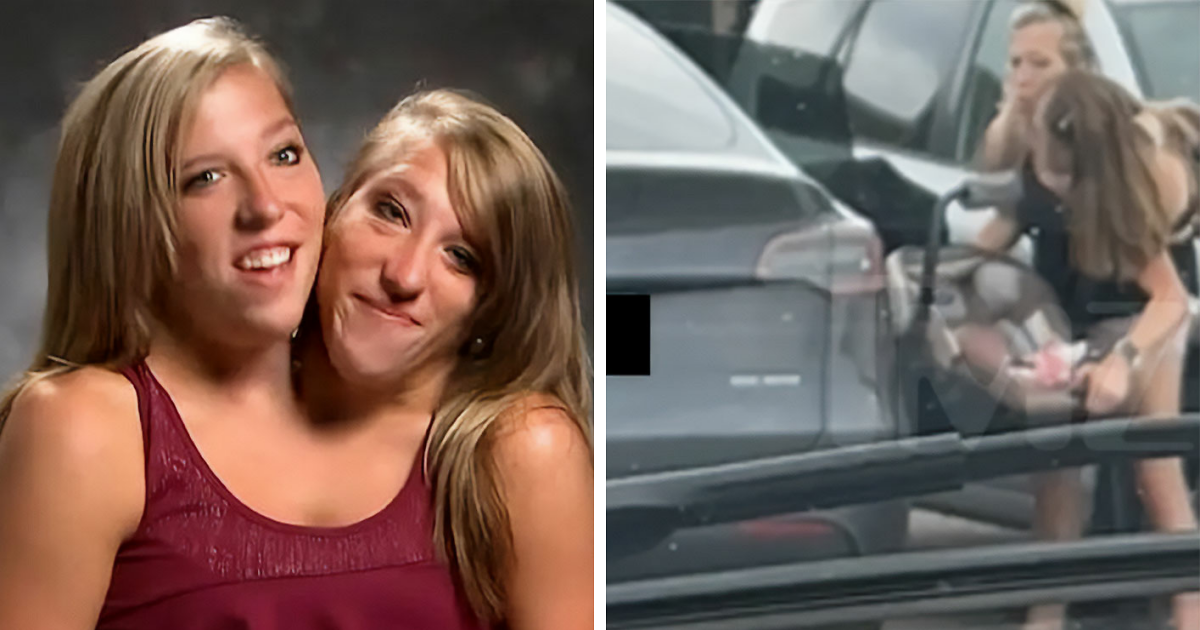 Conjoined Twins Abby And Brittany Hensel Spark Buzz…
