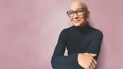 "My loss of identity was overwhelming" –how I learnt to live with alopecia