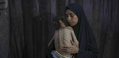 Images from Gaza have shocked the world – but the ‘spectacle of suffering’ is a double-edged sword