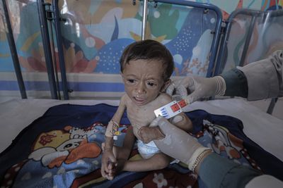 Israel starving Gaza: 271 dead from starvation, including 112 children
