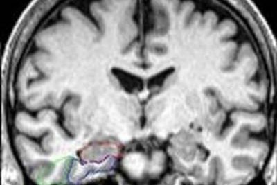 Scientists discover natural compounds found in popular hot drink that protect brain against Alzheimer’s