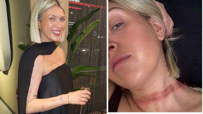 Australian Influencer 'Nearly Decapitated' in Freak Scarf Accident — And Why It Could Happen to You Too