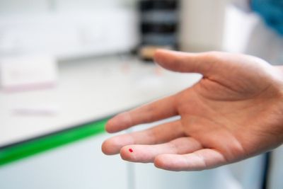 At-home hepatitis C test identifies hundreds with silent but deadly virus